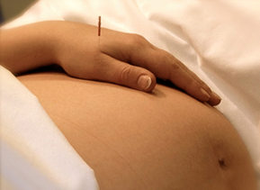 Acupuncture During Pregnancy Seattle WA