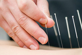 Anxiety Treatment with Acupuncture Seattle WA