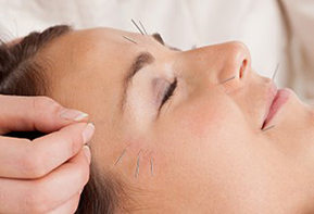 Acupuncture on Face Seattle WA